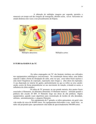 14
A obtenção de múltiplas imagens por segundo, permitiu o
manuseio em tempo real das imagens de tomografia, abrindo assim, novos horizontes no
estudo dinâmico dos vasos e nos procedimentos de biópsia.
Múltiplos detectores Múltiplos cortes
O TUBO de RAIOS-X do TC
Os tubos empregados em TC são bastante similares aos utilizados
nos equipamentos radiológicos convencionais. Na constituição desses tubos, uma ênfase
especial é dada a forma de dissipação do calor, uma vez que, esses tubos ficam sujeitos a
uma maior frequência de exposição, exposições mais longas e, altas doses de exposição.
A sua disposição no interior do gantry, particularmente no que se refere ao eixo catodo-
anodo, ocorre de forma perpendicular ao seu movimento de rotação, evitando-se assim, a
influência do efeito anódico.
Os tubos de TC possuem, na sua grande maioria, dois pontos focais
associados à filamentos de diferentes dimensões. O filamento menor é utilizado quando a
potência não excede 20 KW. O filamento largo nas doses de alta potência. Alguns
equipamentos, quando usam algoritmos para reconstrução de tecidos de alta densidade,
utilizam, automaticamente, o pequeno filamento.
Nos equipamento de 3ª
geração, os tubos apresentam, em geral, uma
vida média de cerca de 80.000 cortes. No equipamentos helicoidais e nos multi-slice, os
tubos são projetados para apresentarem vida média de aproximadamente 500.000 cortes.
 