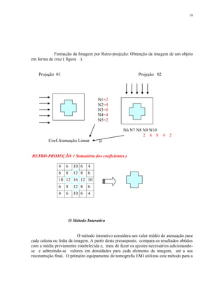 18
Formação da Imagem por Retro-projeção: Obtenção da imagem de um objeto
em forma de cruz ( figura ).
Projeção 01 Projeção 02
N1=2
N2=4
N3=8
N4=4
N5=2
N6 N7 N8 N9 N10
2 4 8 4 2
Coef.Atenuação Linear
RETRO-PROJEÇÃO ( Somatória dos coeficientes )
4 6 10 6 4
6 8 12 8 6
10 12 16 12 10
6 8 12 8 6
4 6 10 6 4
O Método Interativo
O método interativo considera um valor médio de atenuação para
cada coluna ou linha da imagem. A partir deste pressuposto, compara os resultados obtidos
com a média previamente estabelecida e, trata de fazer os ajustes necessários adicionando-
se e subtraindo-se valores em densidades para cada elemento da imagem, até a sua
reconstrução final. O primeiro equipamento de tomografia EMI utilizou este método para a
 
