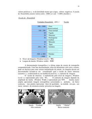 20
valores positivos e, os de densidade menor que a água, valores negativos. A escala
de Hounsfield, assume valores entre –1000 ( ar ) até +1.000 ( chumbo ) .
Escala de Hounsfield
Unidades Hounsfield (HU) / Tecido
300 - 1000 Osso
denso/cortical
100 - 200 Osso normal
60 Fígado
50 Pâncreas
36 Parênquima
Cerebral
20 Músculo
0 Água
-20 à - 80 Gordura
. . . . . . . . . . . . . . . . . . .
. . . . . . . . . . . . . . . . . . .
-500 à -800 Pulmão
- 1000 Ar
Nível da Imagem ( Window Level ) – WL
Largura da Janela ( Window width) – WW
A documentação tomográfica é a última etapa do exame de tomografia
computadorizada. Uma boa documentação, além de demonstrar zelo com o exame,
pode ser decisiva para uma correta interpretação do estudo. As imagens devem ser
documentadas levando-se em consideração qual o tecido de maior interesse
(assunto) e, evidenciando-se, na medida do possível, o contraste da imagem.
O tecido de interesse é estabelecido pelo nível da imagem ( Window
Level ) e representado pelo valor WL. O contraste da imagem depende da
amplitude da Janela (Window Width ) representado por WW. Janelas muito
amplas apresentam imagem tomográficas acinzentadas e, portanto, de baixo
contraste, mas podem representar fator de qualidade, na medida em que, um
maior número de estruturas estarão presentes na imagem.
Janela “Fechada” Janela “Aberta”
Alto contraste Baixo contraste
 