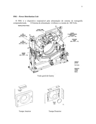 31
PDU – Power Distribution Unit
O PDU é o dispositivo responsável pela alimentação do sistema de tomografia
computadorizada. O Sistema de alimentação é trifásico e a tensão de 480 Volts.
Visão geral do Gantry
Tampa Anterior Tampa Posterior
 