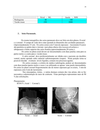 39
/ / / / / / / / / / / / / / / / / / / / / / Nível - WL Janela - WW
Parênquima 40 180
Tecido ósseo 250 2000
2 . Seios Paranasais.
Os exame tomográfico dos seios paranasais deve ser feito em dois planos. O axial
e o coronal. O campo de visão deve estar ajustado às dimensões das cavidades paranasais.
(Aproximadamente 15 cm). Os cortes axiais com 5 mm de espessura – Incremento 0 (zero)
são paralelos ao palato duro e iniciam num plano abaixo dos recessos alveolares e
ultrapassam o limite superior dos seios frontais (aproximadamente 20 cortes ).
Os cortes no plano axial devem ser documentados com duas janelas; uma para as
partes moles e a outra para o tecido ósseo.
A série coronal deve preferencialmente ser obtida com o paciente em decúbito
ventral, mento apoiado sobre material radiotransparente (isopor). Nesta posição torna-se
possível elucidar eventuais níveis líquidos, comuns nos processos agudos.
Os cortes coronais, a critério do médico radiologista, podem ser documentados
com duas janelas (partes moles e ossos ) ou utilizando-se apenas uma janela intermediária.
Os cortes no plano coronal frequentemente são de menor espessura que os axiais, 3 mm de
espessura com 4 mm de incremento.
Nas sinusopatias, rinites, e outras doenças comuns das vias aéreas, não se faz
necessária a administração do meio de contraste. Estas patologias representam mais de 90
% das solicitações.
Planejamento:
SCOUT ( Axial / Coronal )
Scout - Axial Scout - Coronal
 