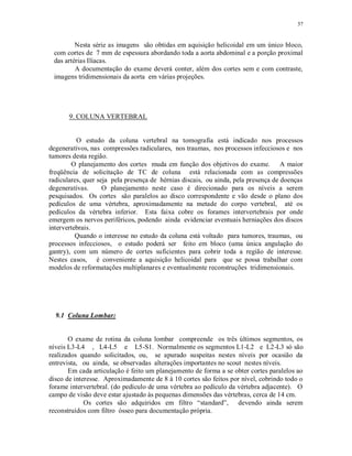 57
Nesta série as imagens são obtidas em aquisição helicoidal em um único bloco,
com cortes de 7 mm de espessura abordando toda a aorta abdominal e a porção proximal
das artérias Ilíacas.
A documentação do exame deverá conter, além dos cortes sem e com contraste,
imagens tridimensionais da aorta em várias projeções.
9. COLUNA VERTEBRAL
O estudo da coluna vertebral na tomografia está indicado nos processos
degenerativos, nas compressões radiculares, nos traumas, nos processos infecciosos e nos
tumores desta região.
O planejamento dos cortes muda em função dos objetivos do exame. A maior
freqüência de solicitação de TC de coluna está relacionada com as compressões
radiculares, quer seja pela presença de hérnias discais, ou ainda, pela presença de doenças
degenerativas. O planejamento neste caso é direcionado para os níveis a serem
pesquisados. Os cortes são paralelos ao disco correspondente e vão desde o plano dos
pedículos de uma vértebra, aproximadamente na metade do corpo vertebral, até os
pedículos da vértebra inferior. Esta faixa cobre os forames intervertebrais por onde
emergem os nervos periféricos, podendo ainda evidenciar eventuais herniações dos discos
intervertebrais.
Quando o interesse no estudo da coluna está voltado para tumores, traumas, ou
processos infecciosos, o estudo poderá ser feito em bloco (uma única angulação do
gantry), com um número de cortes suficientes para cobrir toda a região de interesse.
Nestes casos, é conveniente a aquisição helicoidal para que se possa trabalhar com
modelos de reformatações multiplanares e eventualmente reconstruções tridimensionais.
9.1 Coluna Lombar:
O exame de rotina da coluna lombar compreende os três últimos segmentos, os
níveis L3-L4 , L4-L5 e L5-S1. Normalmente os segmentos L1-L2 e L2-L3 só são
realizados quando solicitados, ou, se apurado suspeitas nestes níveis por ocasião da
entrevista, ou ainda, se observadas alterações importantes no scout nestes níveis.
Em cada articulação é feito um planejamento de forma a se obter cortes paralelos ao
disco de interesse. Aproximadamente de 8 à 10 cortes são feitos por nível, cobrindo todo o
forame intervertebral. (do pedículo de uma vértebra ao pedículo da vértebra adjacente). O
campo de visão deve estar ajustado às pequenas dimensões das vértebras, cerca de 14 cm.
Os cortes são adquiridos em filtro “standard”, devendo ainda serem
reconstruídos com filtro ósseo para documentação própria.
 