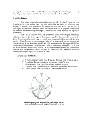 7
no computador podiam então ser utilizados na reconstrução do corte tomográfico. O
feixe do primeiro equipamento tinha dimensões aproximadas de 3 x 13 mm.
Princípios Básicos
Nos atuais tomógrafos computadorizados, um tubo de raios-X emite um feixe
de radiação de forma laminar e de espessura muito fina, da ordem de milímetros, que
atravessa o paciente indo sensibilizar um conjunto de detectores. Estes, por sua vez, se
encarregam de transmitir o sinal em forma de corrente elétrica de pequena intensidade a
um dispositivo eletrônico responsável pela conversão dos sinais elétricos em dígitos de
computador.
Para que a imagem possa ser interpretada como uma imagem anatômica,
múltiplas projeções são feitas a partir de diferentes ângulos. O computador de posse dos
dados obtidos nas diferentes projeções constrói uma imagem digital representada por uma
matriz. Cada elemento de imagem da matriz (pixel) se apresentará com um tom de cinza
correspondente à sua densidade radiológica. Estruturas com alta densidade radiológica,
como por exemplo os ossos, se apresentam “claros” na imagem tomográfica, o ar, pela
sua baixa densidade, se apresenta escuro”. A escala proposta por Hounsfield e largamente
utilizada nos equipamentos atuais, associa as densidades das diferentes estruturas
anatômicas a um grau específico na escala de cinza.
Características do Método
1 .– A Tomografia apresenta feixe de aspecto laminar e em forma de leque.
2. – A aquisição das imagens ocorre no plano do “gantry” o que,
primariamente, gera cortes transversais ao plano do corpo.
3. – A imagem final é digital e pode ser facilmente manipulada por softwares.
4 .– Quanto maior a matriz melhor será a resolução da imagem.
O método tomográfico: Após múltiplas projeções um sistema
computadorizado reconstrói imagens transversais do corpo.
 