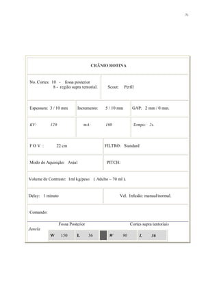 71
CRÂNIO ROTINA
No. Cortes: 10 - fossa posterior
8 - região supra tentorial. Scout: Perfil
Espessura: 3 / 10 mm Incremento: 5 / 10 mm GAP: 2 mm / 0 mm.
KV: 120 mA: 160 Tempo: 2s.
F O V : 22 cm FILTRO: Standard
Modo de Aquisição: Axial PITCH:
Volume de Contraste: 1ml kg/peso ( Adulto ~ 70 ml ).
Delay: 1 minuto Vel. Infusão: manual/normal.
Comando:
Fossa Posterior Cortes supra tentoriais
Janela
W 150 L 36 W 90 L 36
 