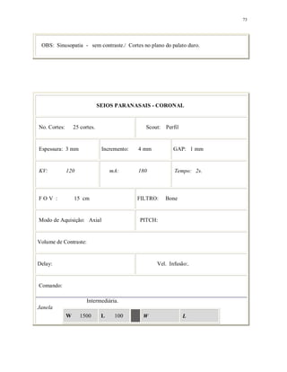73
OBS: Sinusopatia - sem contraste./ Cortes no plano do palato duro.
SEIOS PARANASAIS - CORONAL
No. Cortes: 25 cortes. Scout: Perfil
Espessura: 3 mm Incremento: 4 mm GAP: 1 mm
KV: 120 mA: 180 Tempo: 2s.
F O V : 15 cm FILTRO: Bone
Modo de Aquisição: Axial PITCH:
Volume de Contraste:
Delay: Vel. Infusão:.
Comando:
Intermediária.
Janela
W 1500 L 100 W L
 