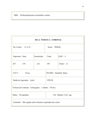 74
OBS: Preferencialmente em decúbito ventral.
SELA TÚRCICA. - CORONAL
No. Cortes: 12 à 15 . Scout: PERFIL
Espessura: 3mm Incremento: 2 mm GAP: - 1.
KV: 120 mA: 180 Tempo: 2s.
F O V : 10 cm FILTRO: Standard / Bone
Modo de Aquisição: Axial PITCH:
Volume de Contraste: 1ml kg/peso ( Adulto ~ 70 ml ).
Delay: 20 segundos Vel. Infusão: 2 ml / seg.
Comando: Não engolir saliva durante a aquisição dos cortes.
 