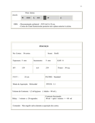 77
Osso denso.
Janela
W 4000 L 400 W L
OBS: - Documentação unilateral - FOV de 8 à 10 cm.
- Cortes do Canal Semicircular posterior até o plano anterior à cóclea.
PESCOÇO
No. Cortes: 30 cortes Scout: Perfil
Espessura: 5 mm Incremento: 5 mm GAP: 0
KV: 120 mA: 220 Tempo: 30 seg.
F O V : 22 cm FILTRO: Standard
Modo de Aquisição: Helicoidal PITCH: 1:1
Volume de Contraste: 1,2 ml kg/peso ( Adulto ~ 80 ml ).
Delay: 1 minuto e 20 segundos
Contraste fracionado.
40 ml > após 1 minuto > + 40 ml
Comando: Não engolir saliva durante a aquisição dos cortes.
 