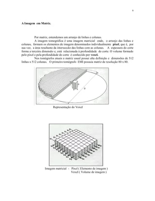 8
A Imagem em Matriz.
Por matriz, entendemos um arranjo de linhas e colunas.
A imagem tomográfica é uma imagem matricial onde, o arranjo das linhas e
colunas, formam os elementos de imagem denominados individualmente pixel, que é, por
sua vez, a área resultante da interseccão das linhas com as colunas. A espessura do corte
forma a terceira dimensão e, está relacionada à profundidade do corte. O volume formado
pelo pixel e pela profundidade do corte é conhecido por voxel.
Nos tomógrafos atuais a matriz usual possui alta definição e dimensões de 512
linhas x 512 colunas. O primeiro tomógrafo EMI possuia matriz de resolução 80 x 80.
Representação do Voxel
Imagem matricial - Pixel ( Elemento de imagem )
Voxel ( Volume de imagem )
 