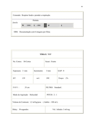 80
Comando: Respirar fundo e prender a respiração.
Pulmão.
Janela
W 1800 L - 800 W L
OBS: Documentação com 6 imagens por filme.
TÓRAX TEP
No. Cortes: 50 Cortes Scout : Frente
Espessura: 3 mm Incremento: 3 mm GAP: 0
KV: 120 mA: 300 Tempo: 25s.
F O V : 35 cm FILTRO: Standard .
Modo de Aquisição: Helicoidal PITCH: 2 : 1
Volume de Contraste: 1,5 ml kg/peso ( Adulto ~ 100 ml ).
Delay: 30 segundos Vel. Infusão: 3 ml/seg.
 