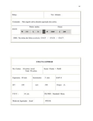 84
Delay: Vel. Infusão:
Comando: Não engolir saliva durante aquisição dos cortes.
Partes moles. Ossos
Janela
W 180 L 36 W 1800 L 200
OBS: Na rotina são feitos os níveis: C4-C5 / C5-C6 / C6-C7.
COLUNA LOMBAR
No. Cortes: 10 cortes / nível.
Total 30 cortes.
Scout : Frente + Perfil
Espessura: 03 mm Incremento: 3 mm GAP: 0
KV: 140 mA: 160 Tempo: 2s.
F O V : 14 cm FILTRO: Standard / Bone.
Modo de Aquisição: Axial PITCH:
 