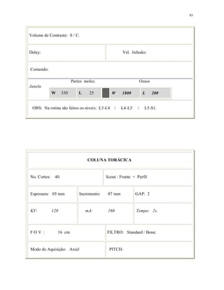 85
Volume de Contraste: S / C.
Delay: Vel. Infusão:
Comando:
Partes moles. Ossos
Janela
W 350 L 25 W 1800 L 200
OBS: Na rotina são feitos os níveis: L3-L4 / L4-L5 / L5-S1.
COLUNA TORÁCICA
No. Cortes: 40. Scout : Frente + Perfil
Espessura: 05 mm Incremento: 07 mm GAP: 2
KV: 120 mA: 160 Tempo: 2s.
F O V : 16 cm FILTRO: Standard / Bone.
Modo de Aquisição: Axial PITCH:
 