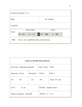 86
Volume de Contraste: S / C.
Delay: Vel. Infusão:
Comando:
Partes moles. Ossos
Janela
W 300 L 10 W 1800 L 200
OBS: Cortes retos espalhados sobre a coluna torácica..
COLUNA SEGMENTO ( BLOCO )
No. Cortes: Depende do segmento. Scout : Frente + Perfil
Espessura: 03 mm Incremento: 03 mm GAP: 0
KV: 120 mA: 260 Tempo: 20 à 40s.
F O V : 16 cm FILTRO: Standard / Bone.
Modo de Aquisição: Helicoidal PITCH: 1:1 à 2:1.
 