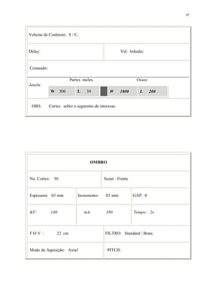 87
Volume de Contraste: S / C.
Delay: Vel. Infusão:
Comando:
Partes moles. Ossos
Janela
W 300 L 30 W 1800 L 200
OBS: Cortes sobre o segmento de interesse.
OMBRO
No. Cortes: 30 Scout : Frente
Espessura: 03 mm Incremento: 03 mm GAP: 0
KV: 140 mA: 180 Tempo: 2s.
F O V : 22 cm FILTRO: Standard / Bone.
Modo de Aquisição: Axial PITCH:
 