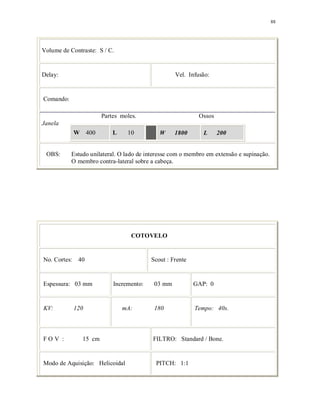 88
Volume de Contraste: S / C.
Delay: Vel. Infusão:
Comando:
Partes moles. Ossos
Janela
W 400 L 10 W 1800 L 200
OBS: Estudo unilateral. O lado de interesse com o membro em extensão e supinação.
O membro contra-lateral sobre a cabeça.
COTOVELO
No. Cortes: 40 Scout : Frente
Espessura: 03 mm Incremento: 03 mm GAP: 0
KV: 120 mA: 180 Tempo: 40s.
F O V : 15 cm FILTRO: Standard / Bone.
Modo de Aquisição: Helicoidal PITCH: 1:1
 
