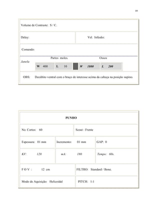 89
Volume de Contraste: S / C.
Delay: Vel. Infusão:
Comando:
Partes moles. Ossos
Janela
W 400 L 10 W 1800 L 200
OBS: Decúbito ventral com o braço de interesse acima da cabeça na posição supino.
PUNHO
No. Cortes: 60 Scout : Frente
Espessura: 01 mm Incremento: 01 mm GAP: 0
KV: 120 mA: 180 Tempo: 60s.
F O V : 12 cm FILTRO: Standard / Bone.
Modo de Aquisição: Helicoidal PITCH: 1:1
 