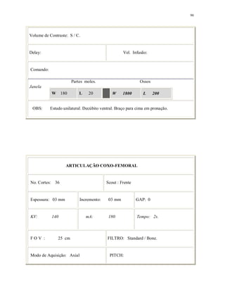 90
Volume de Contraste: S / C.
Delay: Vel. Infusão:
Comando:
Partes moles. Ossos
Janela
W 180 L 20 W 1800 L 200
OBS: Estudo unilateral. Decúbito ventral. Braço para cima em pronação.
ARTICULAÇÃO COXO-FEMORAL
No. Cortes: 36 Scout : Frente
Espessura: 03 mm Incremento: 03 mm GAP: 0
KV: 140 mA: 180 Tempo: 2s.
F O V : 25 cm FILTRO: Standard / Bone.
Modo de Aquisição: Axial PITCH:
 