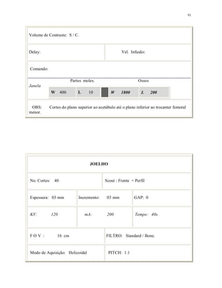 91
Volume de Contraste: S / C.
Delay: Vel. Infusão:
Comando:
Partes moles. Ossos
Janela
W 400 L 10 W 1800 L 200
OBS: Cortes do plano superior ao acetábulo até o plano inferior ao trocanter femoral
menor.
JOELHO
No. Cortes: 40 Scout : Frente + Perfil
Espessura: 03 mm Incremento: 03 mm GAP: 0
KV: 120 mA: 200 Tempo: 40s.
F O V : 16 cm FILTRO: Standard / Bone.
Modo de Aquisição: Helicoidal PITCH: 1:1
 