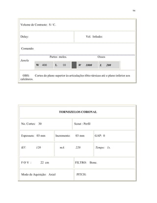 94
Volume de Contraste: S / C.
Delay: Vel. Infusão:
Comando:
Partes moles. Ossos
Janela
W 400 L 10 W 1800 L 200
OBS: Cortes do plano superior às articulações tíbio-társicas até o plano inferior aos
calcâneos.
TORNOZELOS CORONAL
No. Cortes: 30 Scout : Perfil
Espessura: 03 mm Incremento: 03 mm GAP: 0
KV: 120 mA: 220 Tempo: 1s.
F O V : 22 cm FILTRO: Bone.
Modo de Aquisição: Axial PITCH:
 