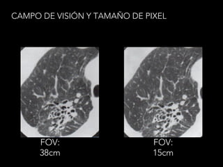 CAMPO DE VISIÓN Y TAMAÑO DE PIXEL
FOV:
38cm
FOV:
15cm
 
