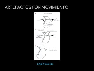 ARTEFACTOS POR MOVIMIENTO
DOBLE CISURA
 