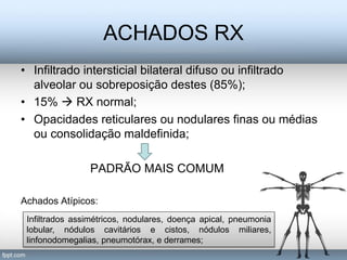 ACHADOS RX
• Infiltrado intersticial bilateral difuso ou infiltrado
  alveolar ou sobreposição destes (85%);
• 15%  RX normal;
• Opacidades reticulares ou nodulares finas ou médias
  ou consolidação maldefinida;

                PADRÃO MAIS COMUM

Achados Atípicos:
 Infiltrados assimétricos, nodulares, doença apical, pneumonia
 lobular, nódulos cavitários e cistos, nódulos miliares,
 linfonodomegalias, pneumotórax, e derrames;
 