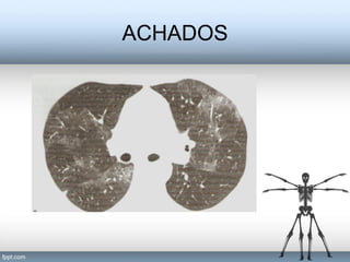 ACHADOS
 