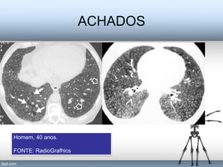 ACHADOS




Homem, 40 anos.

FONTE: RadioGrafhics
 