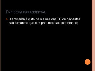 ENFISEMA PARASSEPTAL
   O enfisema é visto na maioria das TC de pacientes
    não-fumantes que tem pneumotórax espontâneo;
 
