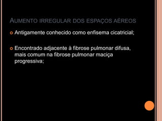 AUMENTO IRREGULAR DOS ESPAÇOS AÉREOS
   Antigamente conhecido como enfisema cicatricial;

   Encontrado adjacente à fibrose pulmonar difusa,
    mais comum na fibrose pulmonar maciça
    progressiva;
 