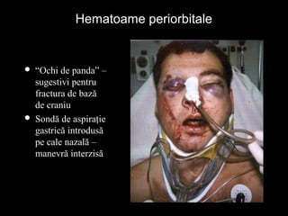 Hematoame periorbitaleHematoame periorbitale
 “Ochi de panda” –
sugestivi pentru
fractura de bază
de craniu
 Sondă de aspiraţie
gastrică introdusă
pe cale nazală –
manevră interzisă
 