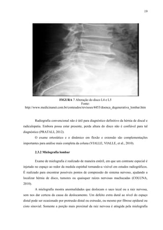 19

FIGURA 7 Alteração do disco L4 e L5
Fonte:
http://www.medicinanet.com.br/conteudos/revisoes/4453/doenca_degenerativa_lombar.htm

Radiografia convencional não é útil para diagnóstico definitivo da hérnia de discal e
radiculopatia. Embora possa estar presente, perda altura do disco não é confiável para tal
diagnóstico (PRATALI, 2012).
O exame ortostático e o dinâmico em flexão e extensão são complementações
importantes para análise mais completa da coluna (VIALLE, VIALLE, et al., 2010).
2.3.2 Mielografia lombar
Exame de mielografia é realizado de maneira estéril, em que um contraste especial é
injetado no espaço ao redor da medula espinhal tornando-a visível em estudos radiográficos.
É realizado para encontrar possíveis pontos de compressão do sistema nervoso, ajudando a
localizar hérnia de disco, tumores ou quaisquer raízes nervosas machucadas (COLUNA,
2010).
A mielografia mostra anormalidades que deslocam o saco tecal ou a raiz nervosa,
sem nos dar certeza da causa do deslocamento. Um defeito extra dural ao nível do espaço
distal pode ser ocasionado por protrusão distal ou extrusão, ou mesmo por fibrose epidural ou
cisto sinovial. Somente a porção mais proximal da raiz nervosa é atingida pela mielografia

 