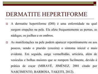 DERMATITE HEPERTIFORME


A dermatite hepertiforme (DH) é uma enfermidade na qual
surgem erupções na pele. Ela afeta frequentemente as pernas, as
nádegas, os joelhos e os ombros.



As manifestações na pele podem aparecer repentinamente ou aos
poucos, sendo o prurido (coceira) o sintoma inicial e mais
evidente. Em seguida, surge vermelhidão, urticária, além de

vesículas e bolhas maiores que se rompem facilmente, devido à
prática de coçar (MIRAVÉ, JIMÉNEZ, 2001 citado por
NASCIMENTO, BARBOSA, TAKEITI, 2012).

 