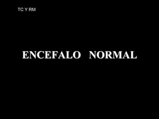 ENCEFALO NORMAL
TC Y RM
 