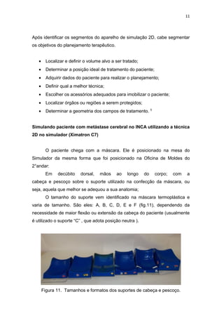 11




Após identificar os segmentos do aparelho de simulação 2D, cabe segmentar
os objetivos do planejamento terapêutico.


   •    Localizar e definir o volume alvo a ser tratado;
   •    Determinar a posição ideal de tratamento do paciente;
   •    Adquirir dados do paciente para realizar o planejamento;
   •    Definir qual a melhor técnica;
   •    Escolher os acessórios adequados para imobilizar o paciente;
   •    Localizar órgãos ou regiões a serem protegidos;
   •    Determinar a geometria dos campos de tratamento. 5


Simulando paciente com metástase cerebral no INCA utilizando a técnica
2D no simulador (Ximatron C7)


        O paciente chega com a máscara. Ele é posicionado na mesa do
Simulador da mesma forma que foi posicionado na Oficina de Moldes do
2°andar:
        Em    decúbito    dorsal,   mãos    ao    longo    do   corpo;   com   a
cabeça e pescoço sobre o suporte utilizado na confecção da máscara, ou
seja, aquela que melhor se adequou a sua anatomia;
        O tamanho do suporte vem identificado na máscara termoplástica e
varia de tamanho. São eles: A, B, C, D, E e F (fig.11), dependendo da
necessidade de maior flexão ou extensão da cabeça do paciente (usualmente
é utilizado o suporte “C” , que adota posição neutra ).




       Figura 11. Tamanhos e formatos dos suportes de cabeça e pescoço.
 