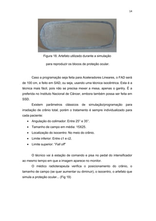 14




                 Figura 18. Artefato utilizado durante a simulação

                  para reproduzir os blocos de proteção ocular.



       Caso a programação seja feita para Aceleradores Lineares, o FAD será
de 100 cm, e feito em SAD, ou seja, usando uma técnica isocêntrica. Esta é a
técnica mais fácil, pois não se precisa mexer a mesa, apenas o gantry. É a
preferida no Instituto Nacional de Câncer, embora também possa ser feita em
SSD.
       Existem     parâmetros    clássicos   de   simulação/programação   para
irradiação de crânio total, porém o tratamento é sempre individualizado para
cada paciente:
   •   Angulação do colimador: Entre 25° e 35°.
   •   Tamanho de campo em média: 15X25.
   •   Localização do isocentro: No meio do crânio.
   •   Limite inferior: Entre c1 e c2.
   •   Limite superior: “Fall off”


       O técnico vai à estação de comando e pisa no pedal do intensificador
ao mesmo tempo em que a imagem aparece no monitor.
       O médico radioterapeuta verifica o posicionamento do crânio, o
tamanho de campo (se quer aumentar ou diminuir), o isocentro, o artefato que
simula a proteção ocular... (Fig 19)
 