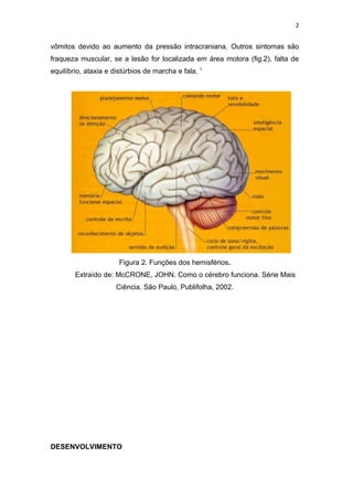 2


vômitos devido ao aumento da pressão intracraniana. Outros sintomas são
fraqueza muscular, se a lesão for localizada em área motora (fig.2), falta de
equilíbrio, ataxia e distúrbios de marcha e fala. 1




                       Figura 2. Funções dos hemisférios.
        Extraído de: McCRONE, JOHN. Como o cérebro funciona. Série Mais
                      Ciência. São Paulo, Publifolha, 2002.




DESENVOLVIMENTO
 