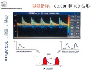 容量指标： CO,CBF 和 TCD 波形 CHINA International Neuroscience Institute ICU 曲线下面积： TCD &Picco 