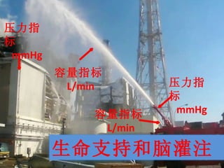 容量指标 L/min 压力指标 mmHg 压力指标 mmHg 容量指标 L/min 生命支持和脑灌注 