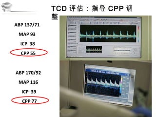 CHINA International Neuroscience Institute ICU TCD 评估：指导 CPP 调整 ABP 137/71  MAP 93  ICP  38  CPP 55 ABP 170/92  MAP 116  ICP  39  CPP 77 评估 治疗 监测 