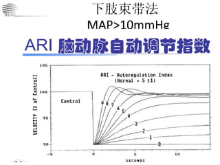 下肢束带法  MAP>10mmHg 