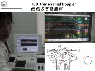CHINA International Neuroscience Institute ICU TCD  transcranial Doppler 经颅多普勒超声 