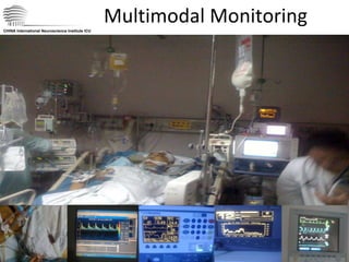 Multimodal Monitoring CHINA International Neuroscience Institute ICU 