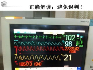 正确解读；避免误判 ！ 