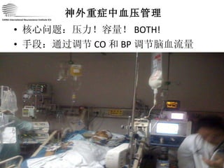神外重症中血压管理 核心问题：压力！容量！ BOTH! 手段：通过调节 CO 和 BP 调节脑血流量 CHINA International Neuroscience Institute ICU 