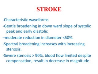 STROKE
-Characteristic waveforms
-Gentle broadening in down ward slope of systolic
peak and early diastolic
–moderate reduction in diameter <50%.
-Spectral broadening increases with increasing
stenosis.
-Severe stenosis > 90%, blood flow limited despite
compensation, result in decrease in magnitude
 
