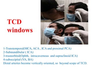1-Transtemporal(MCA, ACA , ICA and proximal PCA)
2-Submandibular ( ICA)
3-trasnorbital(Ophth, intracavernous and supraclinoid ICA)
4-suboccipital (VA, BA)
Distal arteries become vertically oriented, so beyond scope of TCD.
TCD
windows
 