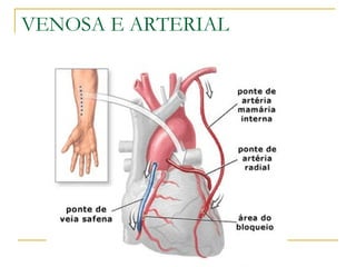 VENOSA E ARTERIAL 