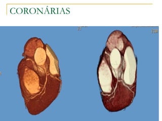 CORONÁRIAS 