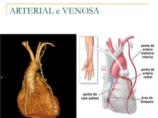 ARTERIAL e VENOSA 