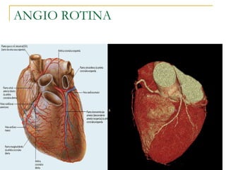 ANGIO ROTINA 